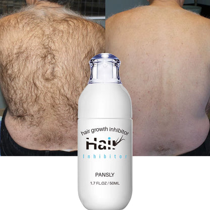 100ML Hair Removal Spray Hair Growth Inhibitor Spray Painless Hair Reduction Permanently Inhibits Hair Growth Skin Silky Smooth